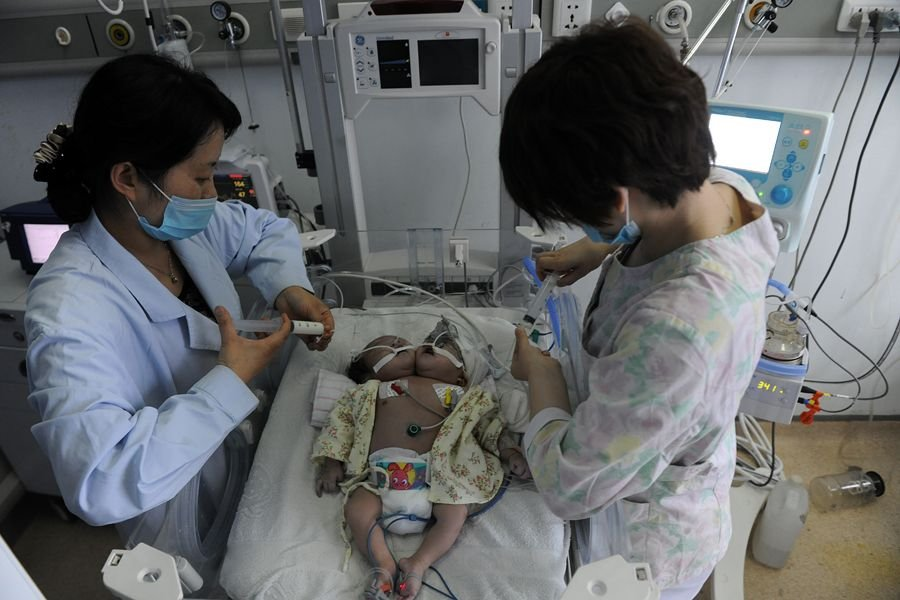 2011年，四川孕妇生下中国首例"双头宝宝"，后将产检医院告上公堂